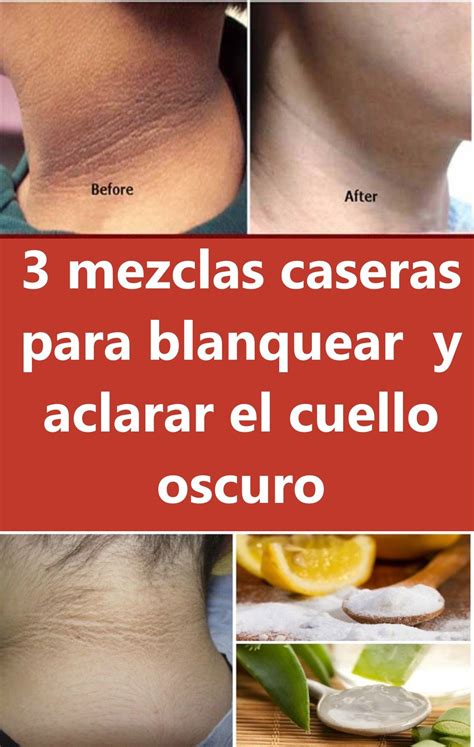 3 Mezclas Caseras Para Blanquear Y Aclarar Tu Cuello En 2021