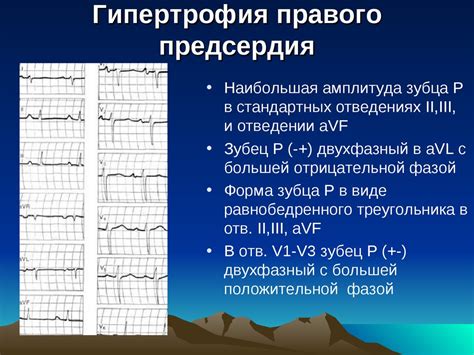 Гипертрофии отделов сердца. Лекция 5 - презентация онлайн