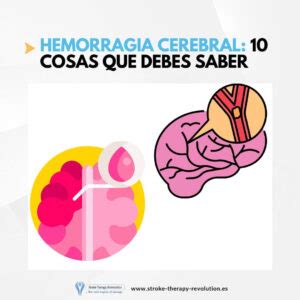 Hemorragia cerebral causas síntomas y tratamiento