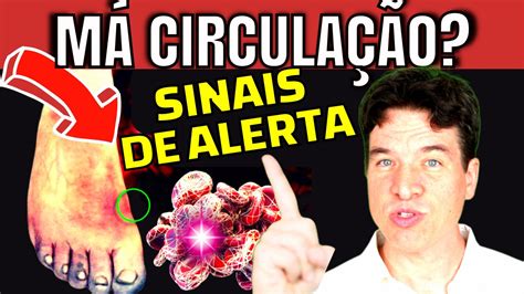 Sintomas Perigosos De M Circula O Nas Pernas Como Melhorar Sua