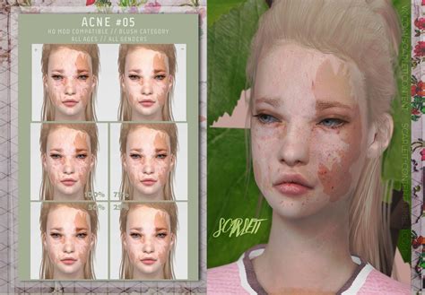 Sims 4 Acne CC