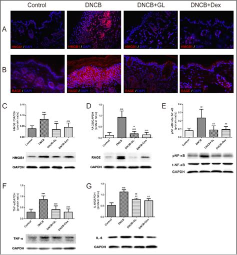 Glycyrrhizin Ameliorates Atopic Dermatitis‐like Symptoms Through