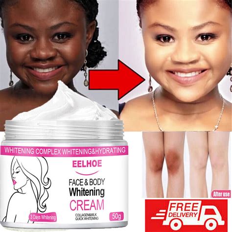 Skin Bleaching Products For Black Skin