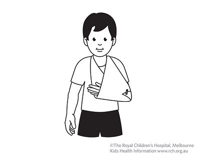 Kids Health Info : Fracture care: clavicle (collar bone)