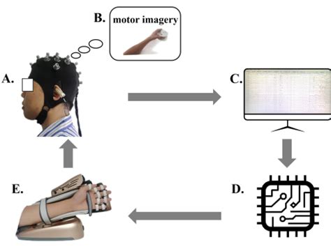 Motor Imagery Brain Computer Interface In Rehabilitation Of Upper Limb