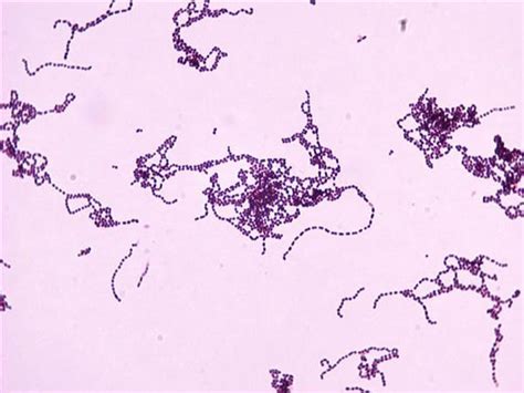 Streptococcus Pyogenes Group A Streptococci Microbiology Medbullets Step 1