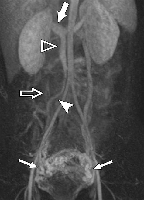 Time Resolved Mr Angiography As A Useful Sequence For Assessment Of