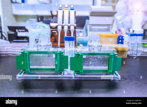 Western Blot Analysis Use As Protein Analysis For Protein Detection