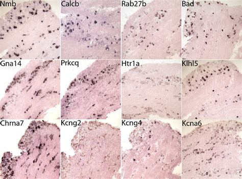 Figure 1 From A Nociceptive Signaling Role For Neuromedin B Semantic