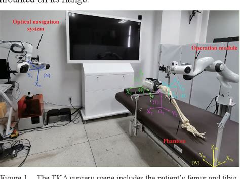 Figure 4 From Pre And Intra Operative Dynamic Registration For Total