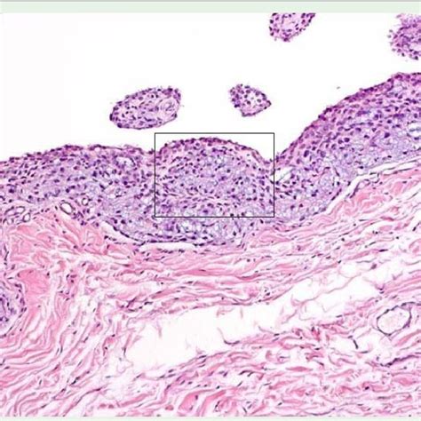 Histopathology Of The Synovial Membrane Of A Control Goats Knee 4