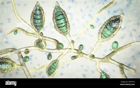 Microsporum canis fungus, illustration Stock Photo - Alamy