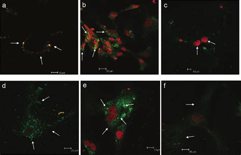 CLSM Analysis Of TG 2 Distribution In Primary Rat Astroglial Cell