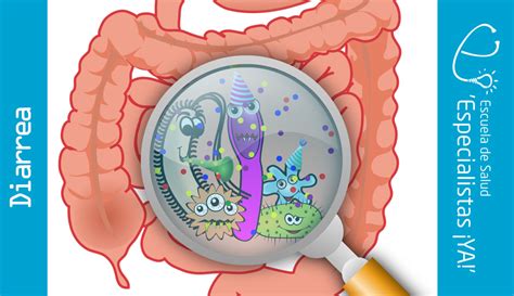 Pediatría Diarrea Observatorio De Salud Especialistas ¡ya