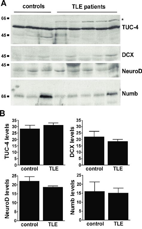 Expression Of Neurogenesis Marker Genes In Human Tle Hippocampus A Download Scientific