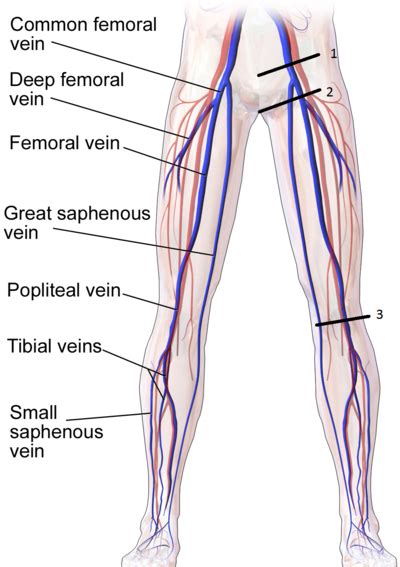 DVT ultrasound - WikEM