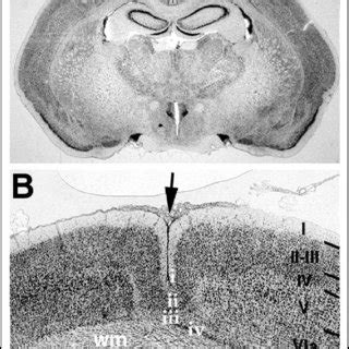 A Photomicrograph Of Section From Adult Rat Illustrating The Presence