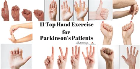 Top Hand Exercise For Parkinson Patients Dr Paresh Doshi