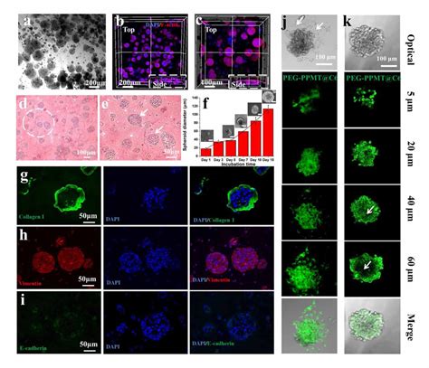 D Bioprinted Tumor Model With Extracellular Matrix Enhanced Bioinks