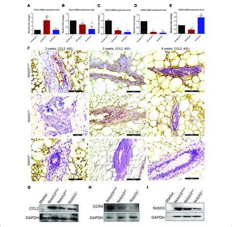 Ccl2 Expression Decreases In Mammary Gland Tissues Of Notch3 Knockout