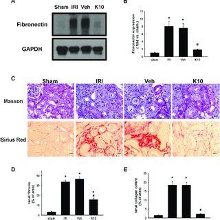 KS370G Regulates The Expression Of Fibronectin And Collagen