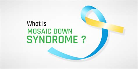 Mosaic Down Syndrome: Causes, Symptoms, Diagnosis, And Treatment