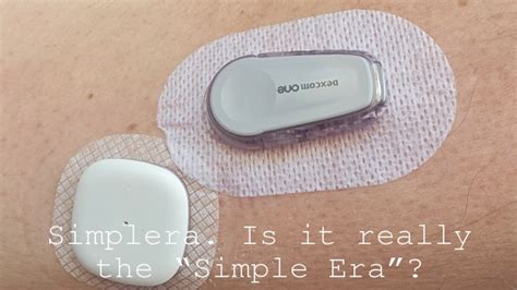 Medtronic Simplera Is It Really The Simple Era Diabettech