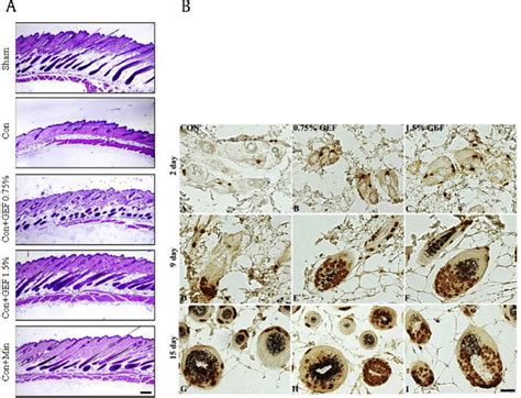 The Representative H E Staining And BrdU Incorporation Of Skin Sections