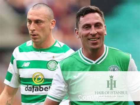 Scott Brown Hair Transplant The Untold Story Revealed