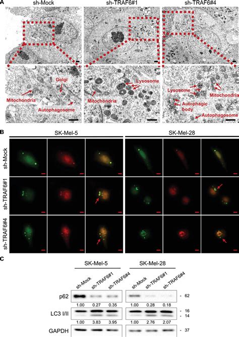 Knocking Down Of TRAF6 Induces Autophagy In Melanoma Cells A