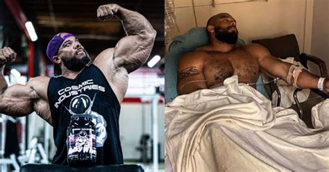 Sergio Oliva Jr. Hospitalized With 'The Worst Pain I've Ever Been In ...