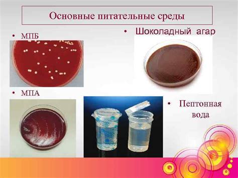 Питательные среды для культивирования и их классификация Подготовила