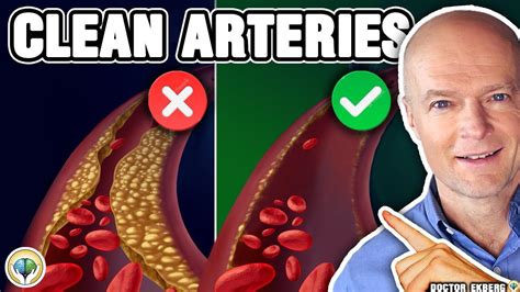 Top 10 Foods To Unclog Arteries Naturally And Prevent Heart Attack