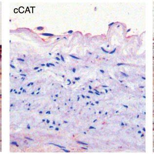 Representative Photomicrographs Showing Immunohistochemistry Staining