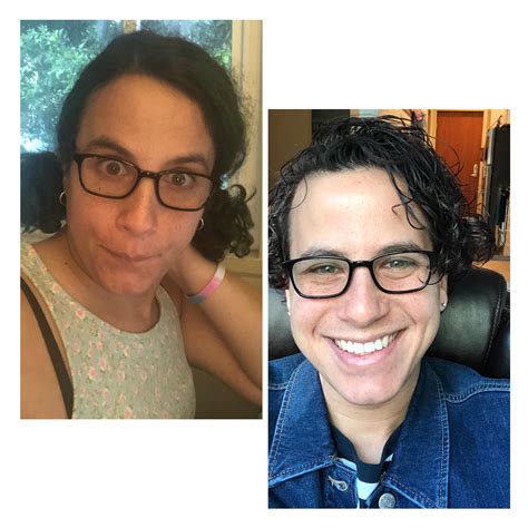 L Today 14 Months Hrt R Exactly One Year Ago 2 Months Hrt Quite Happy With The