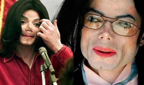 Michael Jackson died 'underweight and covered in hidden cuts and bruises' | Music ...