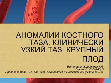 Крупный плод - online presentation