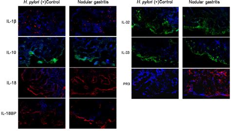 The Immunofluorescence Staining Of Cytokines In The Stomach Of Patients