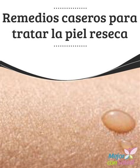 Remedios Caseros Para La Piel Reseca Mejor Con Salud Piel Reseca