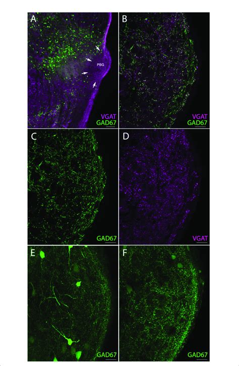 Gad67 Neurons Provide A Source Of Non Tectal Gabaergic Terminals In The