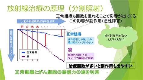 がん放射線治療のしくみ らくわ健康教室 講演録