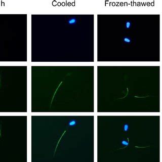 Representative Photographs Of Immunostaining For Aqp In Fresh Cooled