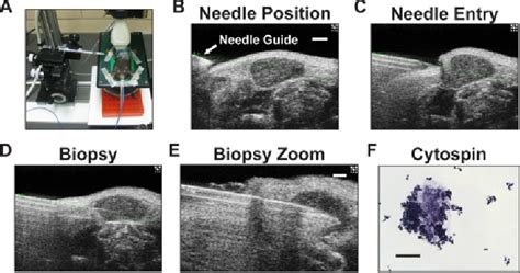 Cervical Lymph Node Biopsy Set Up Imaging And Cytospin Analysis Of Download Scientific Diagram