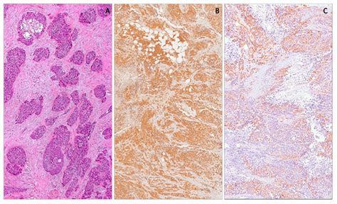 Applied Sciences Free Full Text Immunohistochemical Expression Of