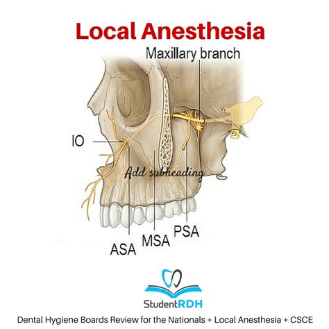 Q: The infraorbital nerve block does NOT affect the: - StudentRDH Blog