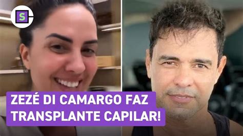 Zez Di Camargo Careca Graciele Lacerda Faz V Deo E Revela Transplante