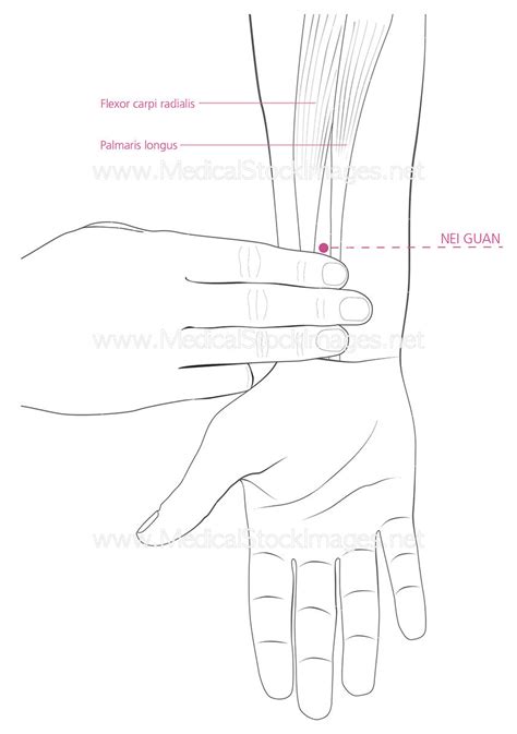 Neiguan Acupuncture Point – Medical Stock Images Company