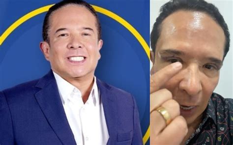 Gustavo Adolfo Infante Se Hace Cirug A Est Tica Y As Qued Fotos Fama