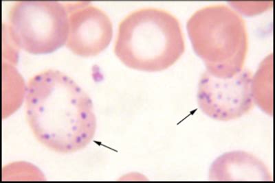 FICHERO DE HEMATOLOGIA PUNTEADO BASÓFILO