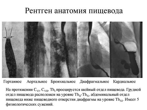 Нормальная лучевая анатомия желудочно-кишечного тракта - презентация онлайн